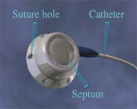 Vascular access port